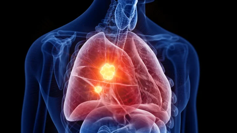 Novo medicamento para mesotelioma usa defesas do câncer contra ele mesmo