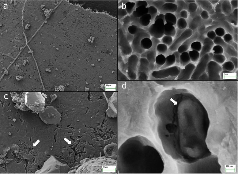 Bacterial Degradation of Plastic Film in Forest Soil