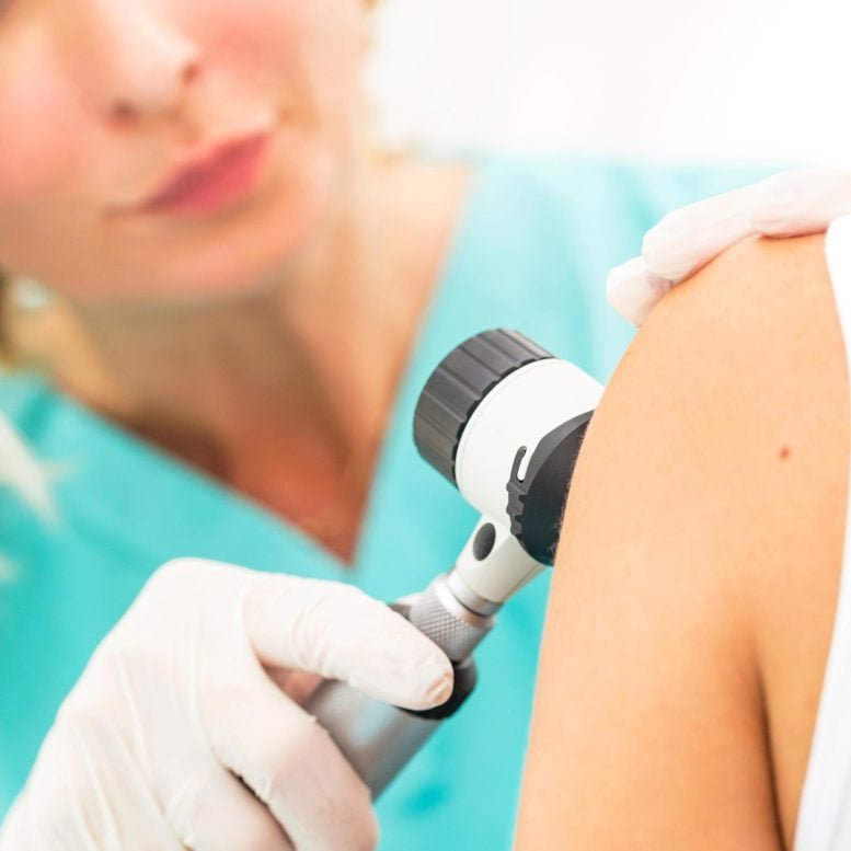Doctor Checking Skin Cancer Melanoma Photo