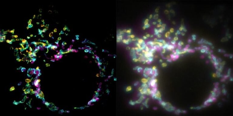 Nova tecnologia de microscopia revela processos celulares