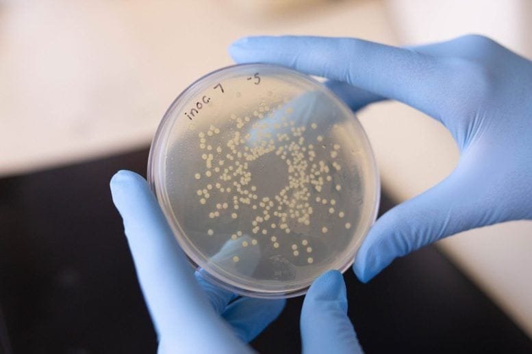 UTI Causing Bacterial Colonies