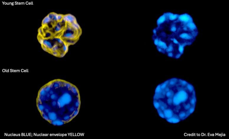 Young and Old Stem Cell Nuclei