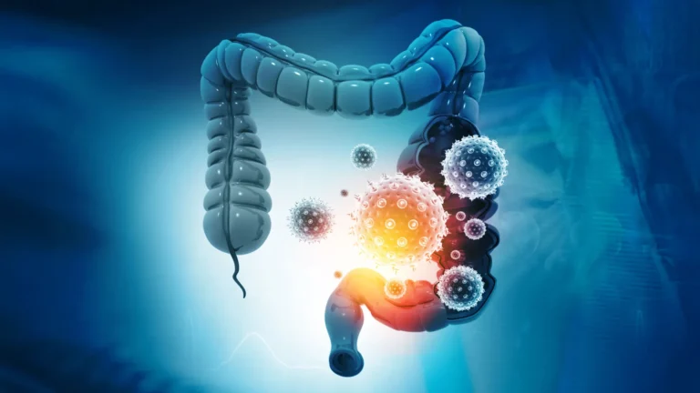 Cientistas descobrem como bactéria intestinal provoca câncer de cólon