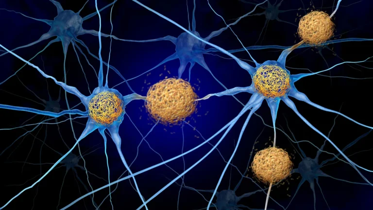 Peptídeo P3 pode ser novo fator no Alzheimer, aponta estudo